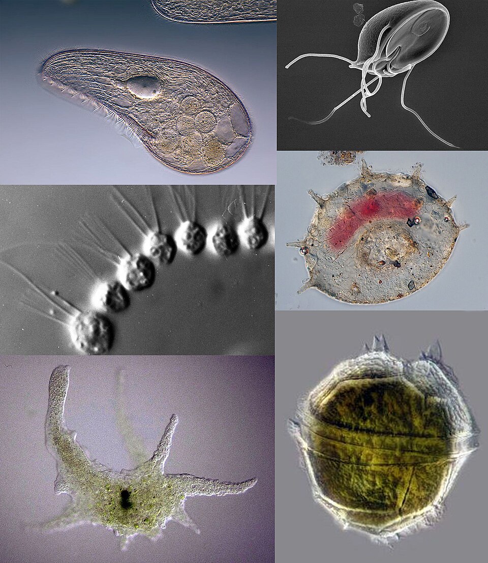 Various protozoa under microscope